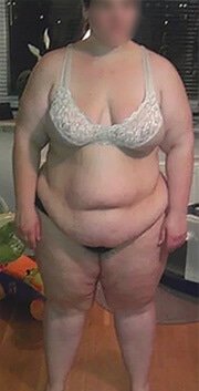 Prima del trattamento con Keto Slim Cream